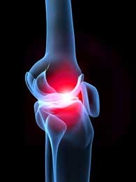 Ligamentous Injury - Anterior Knee Pain